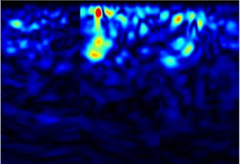 Latent Defect Diagnostics